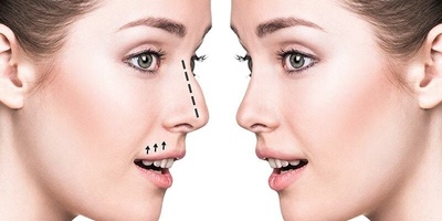 ترجمه مقالات فوق تخصص جراحی پلاستیک، ترمیمی و زیبایی